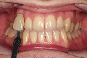 Before - Shirley Dental