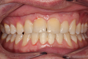 Before - Shirley Dental
