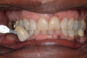 Before - Shirley Dental