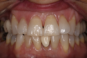 Before - Shirley Dental