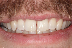 Before - Shirley Dental