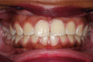 Before - Shirley Dental