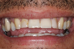 Before - Shirley Dental