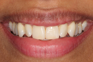 Before - Shirley Dental